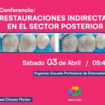 Estomatología - Conferencia Restauraciones indirectas en el sector posterior